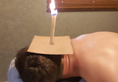 טיפול נרות הופי